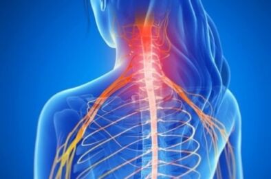 Rook sindrome